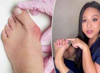 Holistic Approach to Treating Bunions and Plantar Fasciitis: The Benefits of ‘Holding Hands with Your Feet’ holistic-approach-to-treating-bunions-and-plantar-fasciitis-the-benefits-of-holding-hands-with-your-feet