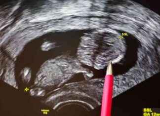 New Prenatal Leave Benefits for Expectant Parents in New York: What You Need to Know new-prenatal-leave-benefits-for-expectant-parents-in-new-york-what-you-need-to-know