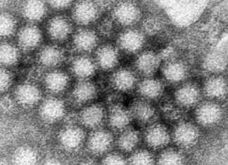How to Stay Safe from Norovirus Outbreaks in Chicago: Important Information how-to-stay-safe-from-norovirus-outbreaks-in-chicago-mportant-nformation